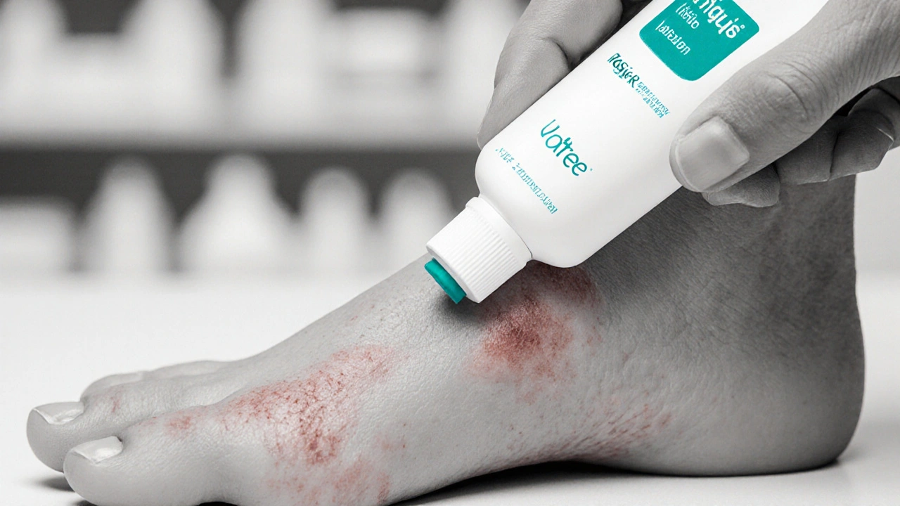 Candid B Lotion vs Other Antifungal Steroid Lotions: Comparison & Alternatives